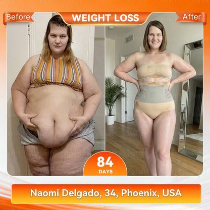 👙👙𝐎𝐟𝐟𝐢𝐜𝐢𝐚𝐥 𝐁𝐫𝐚𝐧𝐝 𝐒𝐭𝐨𝐫𝐞 | Von𝑢𝑡𝑟𝑖® 𝟐𝟎𝟐𝟔 𝐌𝐨𝐫𝐢𝐧𝐠𝐚 & 𝐁𝐞𝐫𝐛𝐞𝐫𝐢𝐧𝐞 𝟒-𝐈𝐧-𝟏 𝐌𝐢𝐜𝐫𝐨-𝐏𝐚𝐫𝐭𝐢𝐜𝐥𝐞 𝐒𝐜𝐮𝐥𝐩𝐭𝐢𝐧𝐠 & 𝐅𝐚𝐭-𝐁𝐮𝐫𝐧 𝐒𝐡𝐨𝐫𝐭𝐬