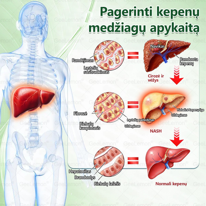 👩‍⚕️ Oficiali „Eurovaistinė“ vaistinė🎁 𝐆𝐞𝑒𝐿𝑒𝐦𝐨𝐧® 𝐆𝐥𝐮𝐦𝐚𝐬𝐞𝐭𝐢𝐝𝐞 8 viename Liekninantis ir sveikatinantis nano pleistras su mikroadatomis 🇱🇹 (Tik kartą per dieną, matomi pokyčiai jau per 7 dienas)  ✅