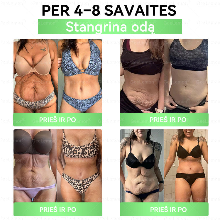 👩‍⚕️ Oficiali „Eurovaistinė“ vaistinė🎁 𝐆𝐞𝑒𝐿𝑒𝐦𝐨𝐧® 𝐆𝐥𝐮𝐦𝐚𝐬𝐞𝐭𝐢𝐝𝐞 8 viename Liekninantis ir sveikatinantis nano pleistras su mikroadatomis 🇱🇹 (Tik kartą per dieną, matomi pokyčiai jau per 7 dienas)  ✅