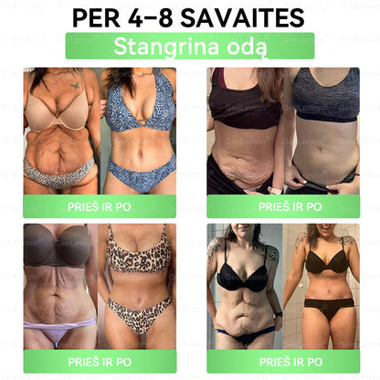 👩‍⚕️ Oficiali „Eurovaistinė“ vaistinė🎁 𝐆𝐞𝑒𝐿𝑒𝐦𝐨𝐧® 𝐆𝐥𝐮𝐦𝐚𝐬𝐞𝐭𝐢𝐝𝐞 8 viename Liekninantis ir sveikatinantis nano pleistras su mikroadatomis 🇱🇹 (Tik kartą per dieną, matomi pokyčiai jau per 7 dienas)  ✅