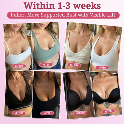🌺𝐇𝐈𝐒𝐊𝐈𝐍® 𝐏𝐃𝐑𝐍 𝐏𝐢𝐧𝐤 𝐂𝐨𝐥𝐥𝐚𝐠𝐞𝐧 𝐒𝐭𝐞𝐦𝐋𝐢𝐟𝐭 𝐏𝐥𝐮𝐦𝐩𝐢𝐧𝐠 𝐌𝐮𝐥𝐭𝐢 𝐁𝐚𝐥𝐦 𝐟𝐨𝐫 𝐔𝐧𝐝𝐞𝐫-𝐄𝐲𝐞𝐬, 𝐍𝐞𝐜𝐤, 𝐅𝐨𝐫𝐞𝐡𝐞𝐚𝐝, 𝐒𝐦𝐢𝐥𝐞 𝐋𝐢𝐧𝐞𝐬,𝐅𝐢𝐫𝐦𝐢𝐧𝐠, 𝐋𝐢𝐟𝐭𝐢𝐧𝐠, 𝐅𝐮𝐥𝐥𝐞𝐫-𝐋𝐨𝐨𝐤𝐢𝐧𝐠 𝐂𝐮𝐫𝐯𝐞𝐬 & 𝐒𝐤𝐢𝐧 𝐂𝐨𝐦𝐟𝐨𝐫𝐭
