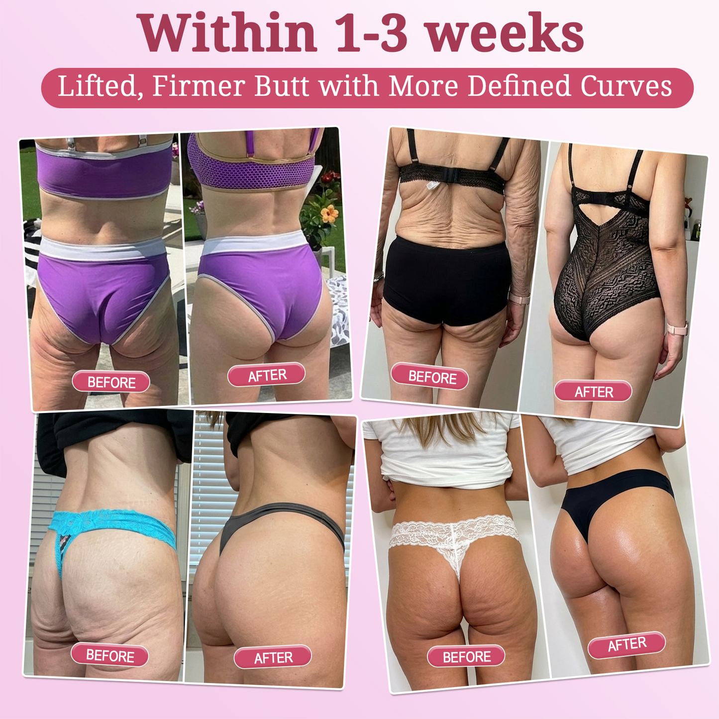 🌺𝐇𝐈𝐒𝐊𝐈𝐍® 𝐏𝐃𝐑𝐍 𝐏𝐢𝐧𝐤 𝐂𝐨𝐥𝐥𝐚𝐠𝐞𝐧 𝐒𝐭𝐞𝐦𝐋𝐢𝐟𝐭 𝐏𝐥𝐮𝐦𝐩𝐢𝐧𝐠 𝐌𝐮𝐥𝐭𝐢 𝐁𝐚𝐥𝐦 𝐟𝐨𝐫 𝐔𝐧𝐝𝐞𝐫-𝐄𝐲𝐞𝐬, 𝐍𝐞𝐜𝐤, 𝐅𝐨𝐫𝐞𝐡𝐞𝐚𝐝, 𝐒𝐦𝐢𝐥𝐞 𝐋𝐢𝐧𝐞𝐬,𝐅𝐢𝐫𝐦𝐢𝐧𝐠, 𝐋𝐢𝐟𝐭𝐢𝐧𝐠, 𝐅𝐮𝐥𝐥𝐞𝐫-𝐋𝐨𝐨𝐤𝐢𝐧𝐠 𝐂𝐮𝐫𝐯𝐞𝐬 & 𝐒𝐤𝐢𝐧 𝐂𝐨𝐦𝐟𝐨𝐫𝐭