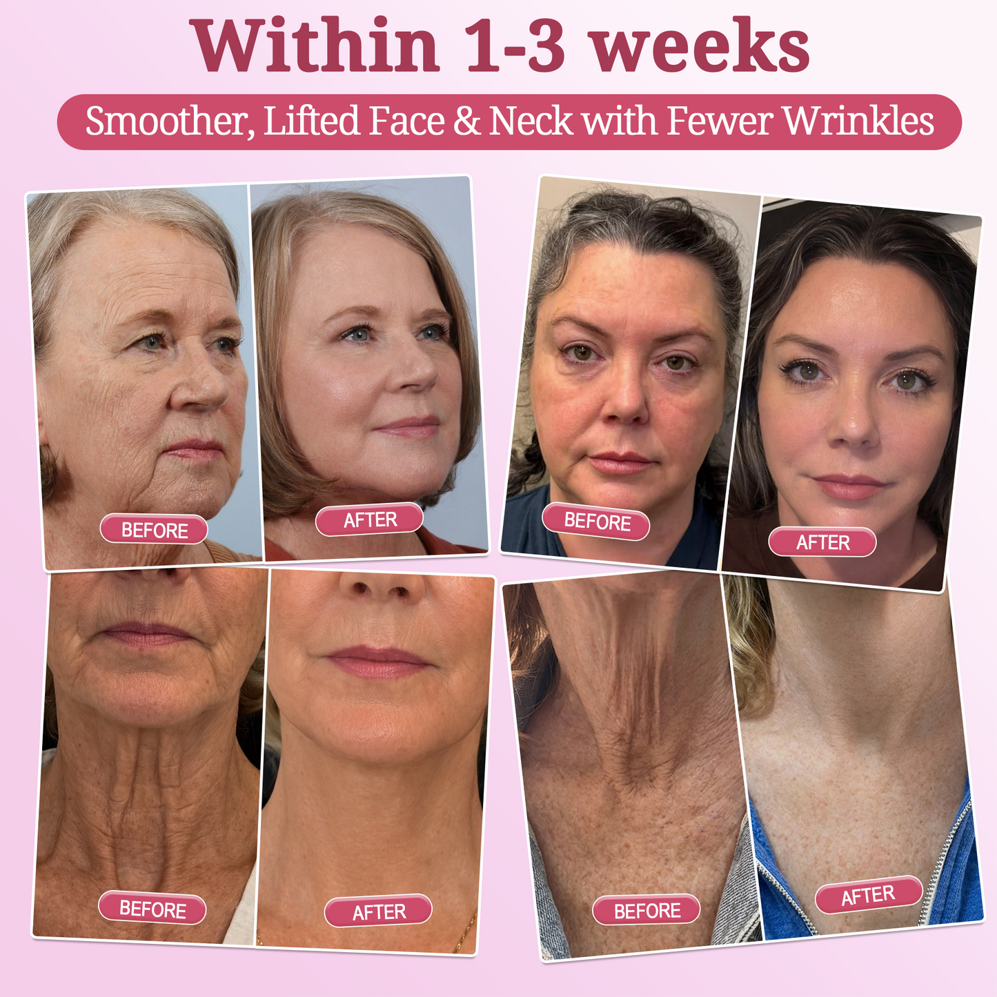 🌺𝐇𝐈𝐒𝐊𝐈𝐍® 𝐏𝐃𝐑𝐍 𝐏𝐢𝐧𝐤 𝐂𝐨𝐥𝐥𝐚𝐠𝐞𝐧 𝐒𝐭𝐞𝐦𝐋𝐢𝐟𝐭 𝐏𝐥𝐮𝐦𝐩𝐢𝐧𝐠 𝐌𝐮𝐥𝐭𝐢 𝐁𝐚𝐥𝐦 𝐟𝐨𝐫 𝐔𝐧𝐝𝐞𝐫-𝐄𝐲𝐞𝐬, 𝐍𝐞𝐜𝐤, 𝐅𝐨𝐫𝐞𝐡𝐞𝐚𝐝, 𝐒𝐦𝐢𝐥𝐞 𝐋𝐢𝐧𝐞𝐬,𝐅𝐢𝐫𝐦𝐢𝐧𝐠, 𝐋𝐢𝐟𝐭𝐢𝐧𝐠, 𝐅𝐮𝐥𝐥𝐞𝐫-𝐋𝐨𝐨𝐤𝐢𝐧𝐠 𝐂𝐮𝐫𝐯𝐞𝐬 & 𝐒𝐤𝐢𝐧 𝐂𝐨𝐦𝐟𝐨𝐫𝐭