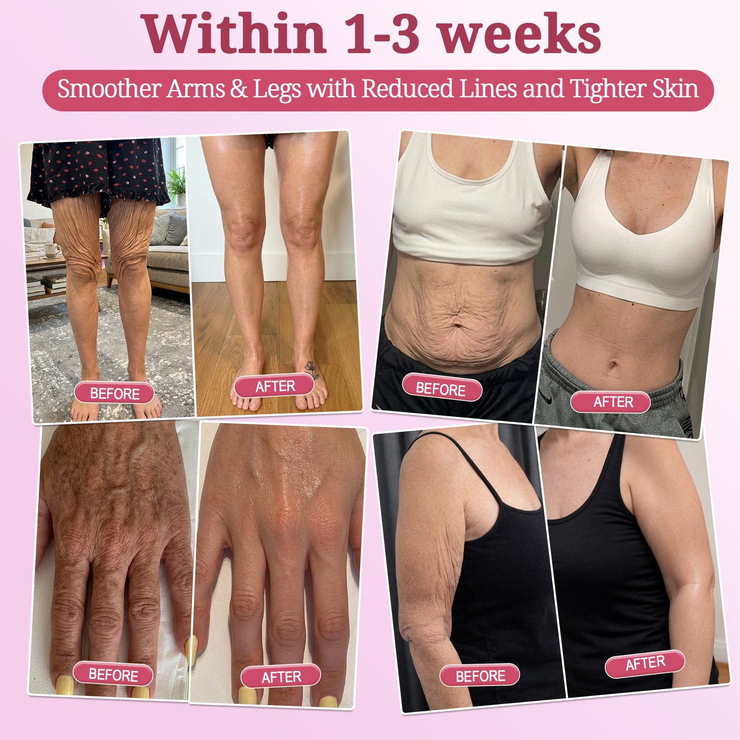 🌺𝐇𝐈𝐒𝐊𝐈𝐍® 𝐏𝐃𝐑𝐍 𝐏𝐢𝐧𝐤 𝐂𝐨𝐥𝐥𝐚𝐠𝐞𝐧 𝐒𝐭𝐞𝐦𝐋𝐢𝐟𝐭 𝐏𝐥𝐮𝐦𝐩𝐢𝐧𝐠 𝐌𝐮𝐥𝐭𝐢 𝐁𝐚𝐥𝐦 𝐟𝐨𝐫 𝐔𝐧𝐝𝐞𝐫-𝐄𝐲𝐞𝐬, 𝐍𝐞𝐜𝐤, 𝐅𝐨𝐫𝐞𝐡𝐞𝐚𝐝, 𝐒𝐦𝐢𝐥𝐞 𝐋𝐢𝐧𝐞𝐬,𝐅𝐢𝐫𝐦𝐢𝐧𝐠, 𝐋𝐢𝐟𝐭𝐢𝐧𝐠, 𝐅𝐮𝐥𝐥𝐞𝐫-𝐋𝐨𝐨𝐤𝐢𝐧𝐠 𝐂𝐮𝐫𝐯𝐞𝐬 & 𝐒𝐤𝐢𝐧 𝐂𝐨𝐦𝐟𝐨𝐫𝐭