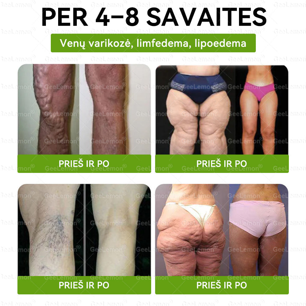 👩‍⚕️ Oficiali „Eurovaistinė“ vaistinė🎁 𝐆𝐞𝑒𝐿𝑒𝐦𝐨𝐧® 𝐆𝐥𝐮𝐦𝐚𝐬𝐞𝐭𝐢𝐝𝐞 8 viename Liekninantis ir sveikatinantis nano pleistras su mikroadatomis 🇱🇹 (Tik kartą per dieną, matomi pokyčiai jau per 7 dienas)  ✅