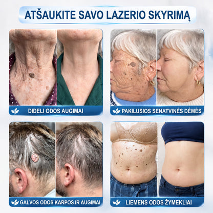👩‍⚕️👩‍⚕️👩‍⚕️𝐎𝐟𝐢𝐜𝐢𝐚𝐥𝐢 𝐩𝐫𝐞𝐤ė𝐬 ž𝐞𝐧𝐤𝐥𝐨 𝐩𝐚𝐫𝐝𝐮𝐨𝐭𝐮𝐯ė Hiskin® 𝟕 𝐝𝐚𝐲 𝐊𝐚𝐫𝐩𝐮𝐜𝐢𝐮 𝐢𝐫 𝐝𝐞𝐦𝐢𝐲 𝐯𝐚𝐥𝐢𝐤𝐥𝐢𝐬(Neskausmingas, be pėdsakų rutulinis rutulinis) 🚀