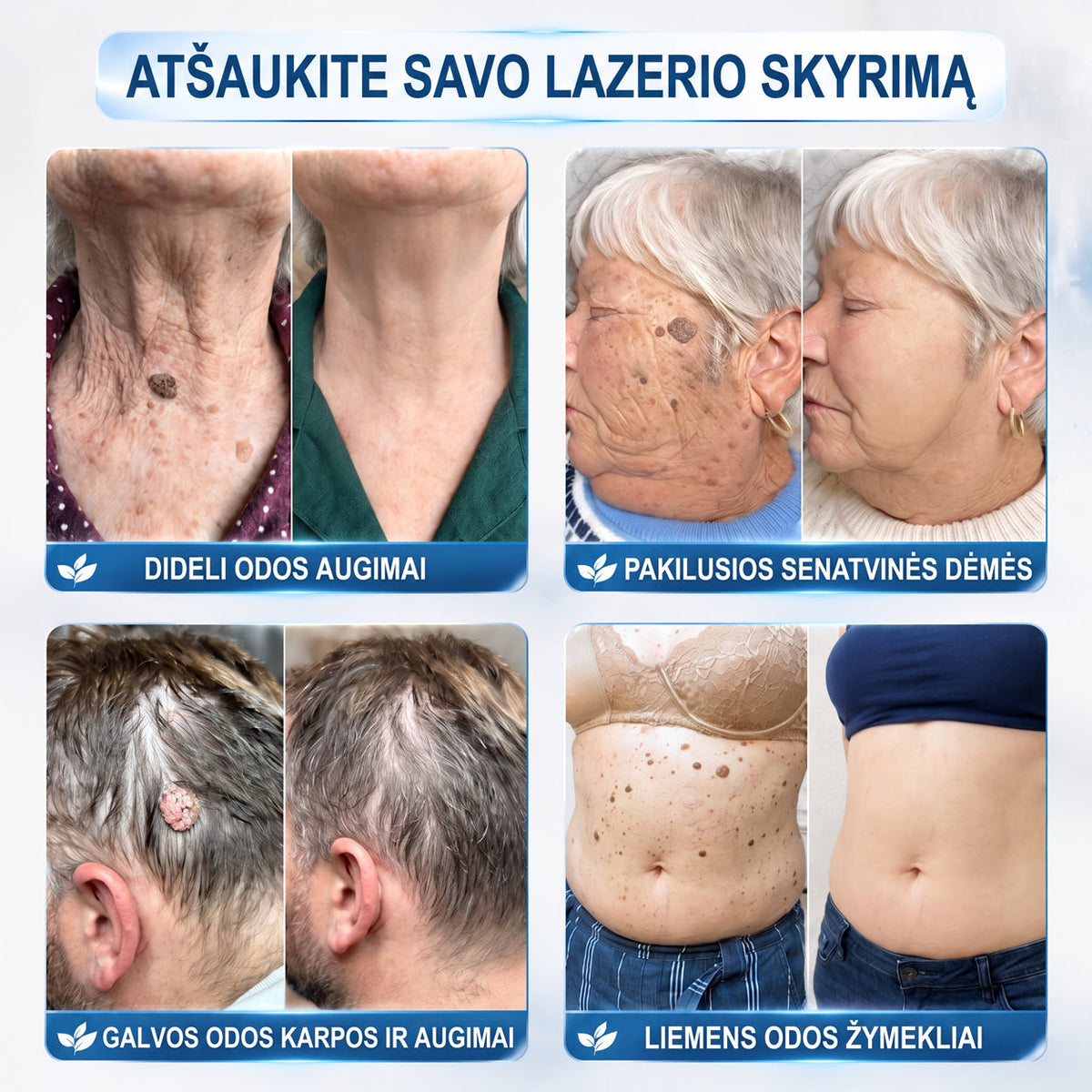 🐳𝐎𝐟𝐢𝐜𝐢𝐚𝐥𝐢 𝐩𝐫𝐞𝐤ė𝐬 ž𝐞𝐧𝐤𝐥𝐨 𝐩𝐚𝐫𝐝𝐮𝐨𝐭𝐮𝐯ė Hiskin® 𝟕 𝐝𝐚𝐲 𝐊𝐚𝐫𝐩𝐮𝐜𝐢𝐮 𝐢𝐫 𝐝𝐞𝐦𝐢𝐲 𝐯𝐚𝐥𝐢𝐤𝐥𝐢𝐬(Neskausmingas, be pėdsakų rutulinis rutulinis) 🚀