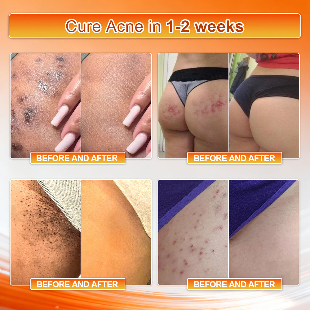 👙👙👙𝐎𝐟𝐟𝐢𝐜𝐢𝐚𝐥 𝐁𝐫𝐚𝐧𝐝 𝐒𝐭𝐨𝐫𝐞 | Von𝑢𝑡𝑟𝑖® 𝟐𝟎𝟐𝟔 𝐌𝐨𝐫𝐢𝐧𝐠𝐚 & 𝐁𝐞𝐫𝐛𝐞𝐫𝐢𝐧𝐞 𝟒-𝐈𝐧-𝟏 𝐌𝐢𝐜𝐫𝐨-𝐏𝐚𝐫𝐭𝐢𝐜𝐥𝐞 𝐒𝐜𝐮𝐥𝐩𝐭𝐢𝐧𝐠 & 𝐅𝐚𝐭-𝐁𝐮𝐫𝐧 𝐒𝐡𝐨𝐫𝐭𝐬