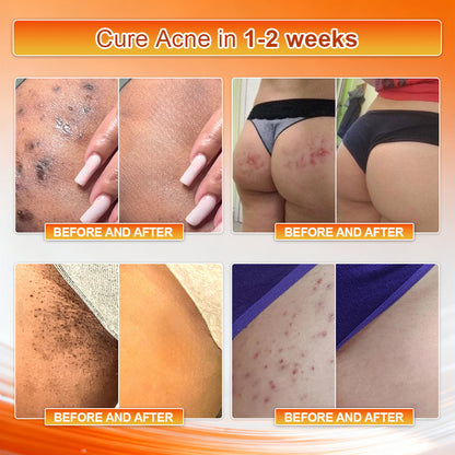 👙👙👙𝐎𝐟𝐟𝐢𝐜𝐢𝐚𝐥 𝐁𝐫𝐚𝐧𝐝 𝐒𝐭𝐨𝐫𝐞 | Von𝑢𝑡𝑟𝑖® 𝟐𝟎𝟐𝟔 𝐌𝐨𝐫𝐢𝐧𝐠𝐚 & 𝐁𝐞𝐫𝐛𝐞𝐫𝐢𝐧𝐞 𝟒-𝐈𝐧-𝟏 𝐌𝐢𝐜𝐫𝐨-𝐏𝐚𝐫𝐭𝐢𝐜𝐥𝐞 𝐒𝐜𝐮𝐥𝐩𝐭𝐢𝐧𝐠 & 𝐅𝐚𝐭-𝐁𝐮𝐫𝐧 𝐒𝐡𝐨𝐫𝐭𝐬