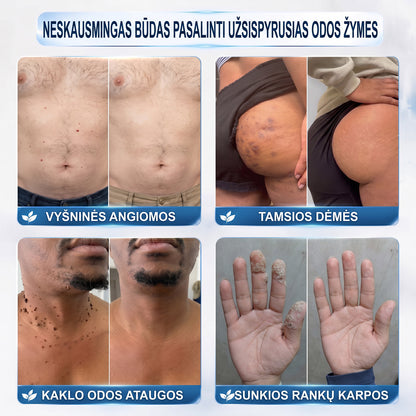👩‍⚕️𝐎𝐟𝐢𝐜𝐢𝐚𝐥𝐢 𝐩𝐫𝐞𝐤ė𝐬 ž𝐞𝐧𝐤𝐥𝐨 𝐩𝐚𝐫𝐝𝐮𝐨𝐭𝐮𝐯ė Hiskin® 𝟕 𝐝𝐚𝐲 𝐊𝐚𝐫𝐩𝐮𝐜𝐢𝐮 𝐢𝐫 𝐝𝐞𝐦𝐢𝐲 𝐯𝐚𝐥𝐢𝐤𝐥𝐢𝐬(Neskausmingas, be pėdsakų rutulinis rutulinis) 🚀