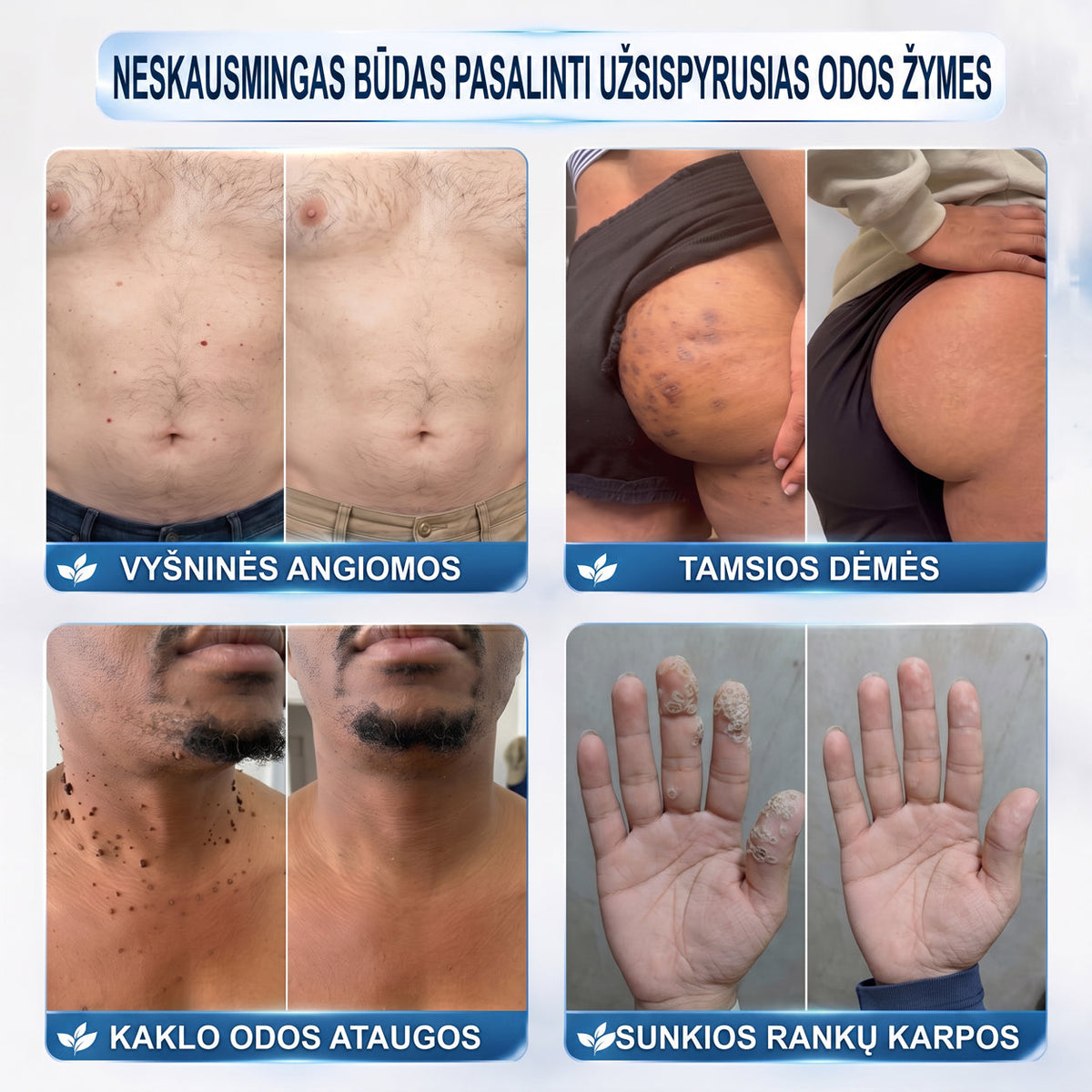 🐳𝐎𝐟𝐢𝐜𝐢𝐚𝐥𝐢 𝐩𝐫𝐞𝐤ė𝐬 ž𝐞𝐧𝐤𝐥𝐨 𝐩𝐚𝐫𝐝𝐮𝐨𝐭𝐮𝐯ė Hiskin® 𝟕 𝐝𝐚𝐲 𝐊𝐚𝐫𝐩𝐮𝐜𝐢𝐮 𝐢𝐫 𝐝𝐞𝐦𝐢𝐲 𝐯𝐚𝐥𝐢𝐤𝐥𝐢𝐬(Neskausmingas, be pėdsakų rutulinis rutulinis) 🚀