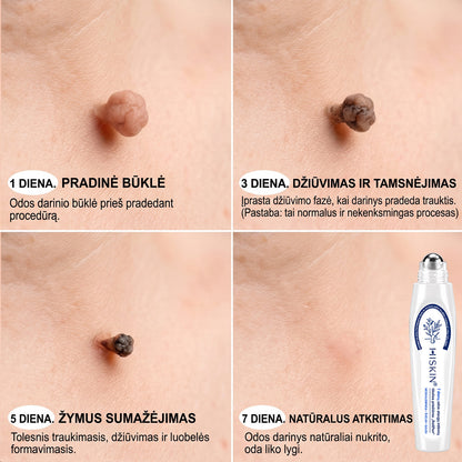 👩‍⚕️👩‍⚕️𝐎𝐟𝐢𝐜𝐢𝐚𝐥𝐢 𝐩𝐫𝐞𝐤ė𝐬 ž𝐞𝐧𝐤𝐥𝐨 𝐩𝐚𝐫𝐝𝐮𝐨𝐭𝐮𝐯ė Hiskin® 𝟕 𝐝𝐚𝐲 𝐊𝐚𝐫𝐩𝐮𝐜𝐢𝐮 𝐢𝐫 𝐝𝐞𝐦𝐢𝐲 𝐯𝐚𝐥𝐢𝐤𝐥𝐢𝐬(Neskausmingas, be pėdsakų rutulinis rutulinis) 🚀