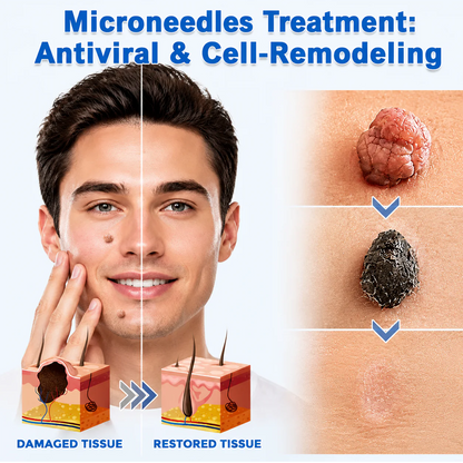 ✨✨Hiskin ® 2-in-1 Microneedle & Hydrocolloid Patch🍀 | Removes raised moles, acne, flat warts, and skin tags | Helps improve wrinkles, scars, and blemishes | Invisible patches for face and body