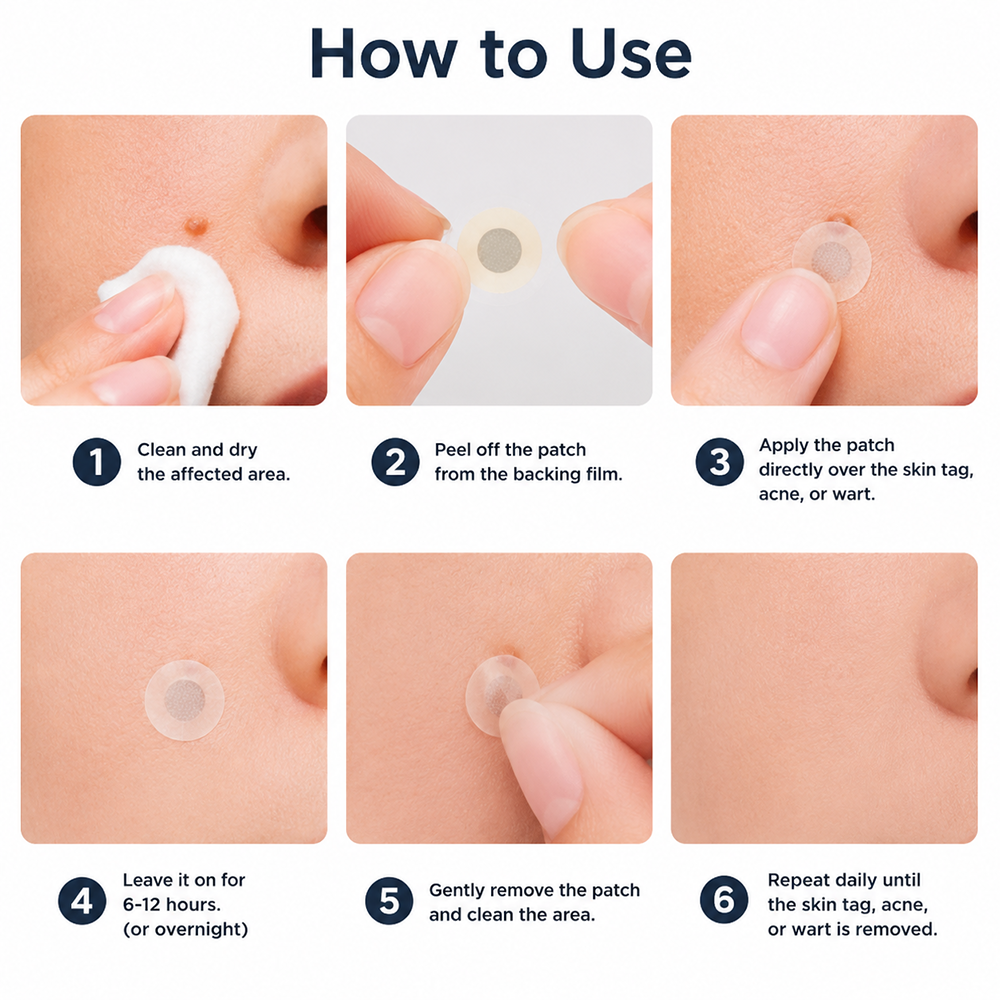 ✨✨Hiskin ® 2-in-1 Microneedle & Hydrocolloid Patch🍀 | Removes raised moles, acne, flat warts, and skin tags | Helps improve wrinkles, scars, and blemishes | Invisible patches for face and body