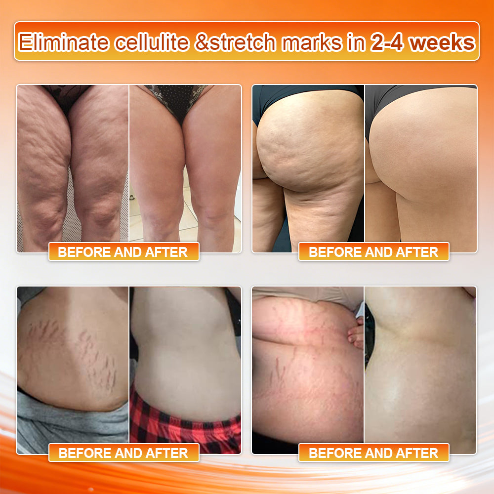 👙👙𝐎𝐟𝐟𝐢𝐜𝐢𝐚𝐥 𝐁𝐫𝐚𝐧𝐝 𝐒𝐭𝐨𝐫𝐞 | Von𝑢𝑡𝑟𝑖® 𝟐𝟎𝟐𝟔 𝐌𝐨𝐫𝐢𝐧𝐠𝐚 & 𝐁𝐞𝐫𝐛𝐞𝐫𝐢𝐧𝐞 𝟒-𝐈𝐧-𝟏 𝐌𝐢𝐜𝐫𝐨-𝐏𝐚𝐫𝐭𝐢𝐜𝐥𝐞 𝐒𝐜𝐮𝐥𝐩𝐭𝐢𝐧𝐠 & 𝐅𝐚𝐭-𝐁𝐮𝐫𝐧 𝐒𝐡𝐨𝐫𝐭𝐬